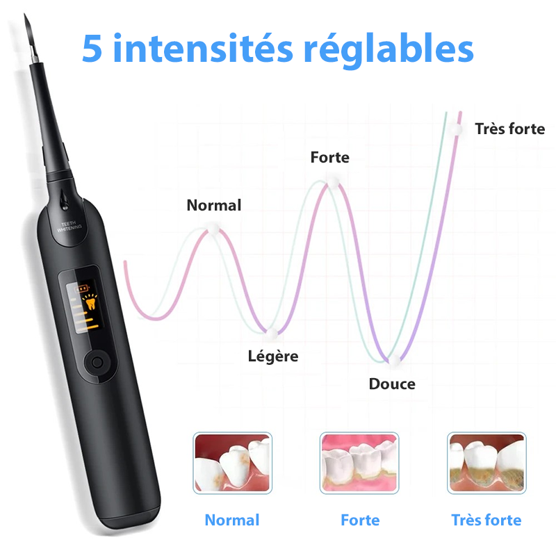 Détartreur Dentaire Professionnel Électrique - Blanchiment Dentaire